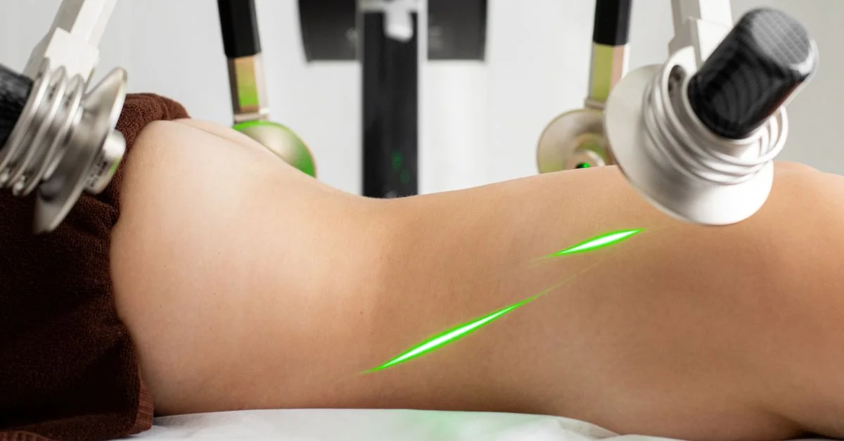 Una sesión moderna de terapia láser para adelgazar en un entorno de clínica de salud.